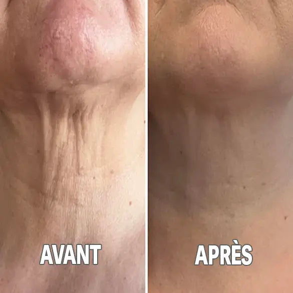 Solène - Crème Raffermissante Lift Cou