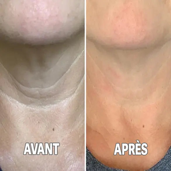 Solène - Crème Raffermissante Lift Cou